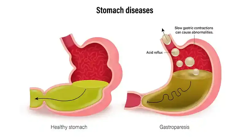 is all compounded semaglutide the same Compounded Semaglutide Online Prescription for Weight Loss
