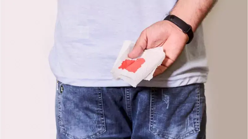 glp 1 rectal bleeding Semaglutide-Associated Ischemic Colitis in a Patient Without Traditional Risk Factors: A Case Report Constipation & Weight Loss Medications
