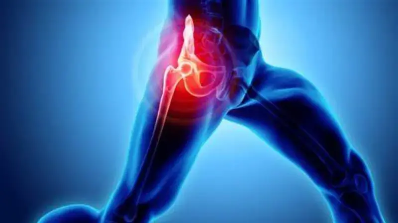 Dislocated Hip : It's Effects, Types And Factors