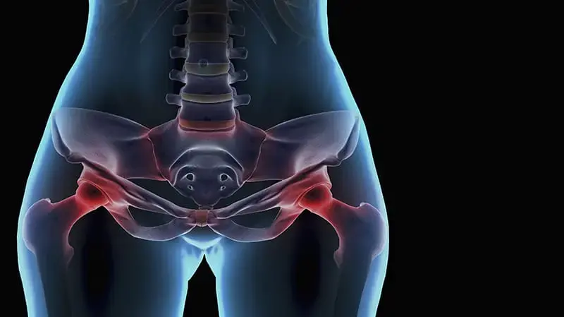 hip pain glp 1 GLP-1 Agonists and Pancreatitis Risk: Reassessing an Old Concern with New Evidence Does GLP-1 Cause Muscle Pain?