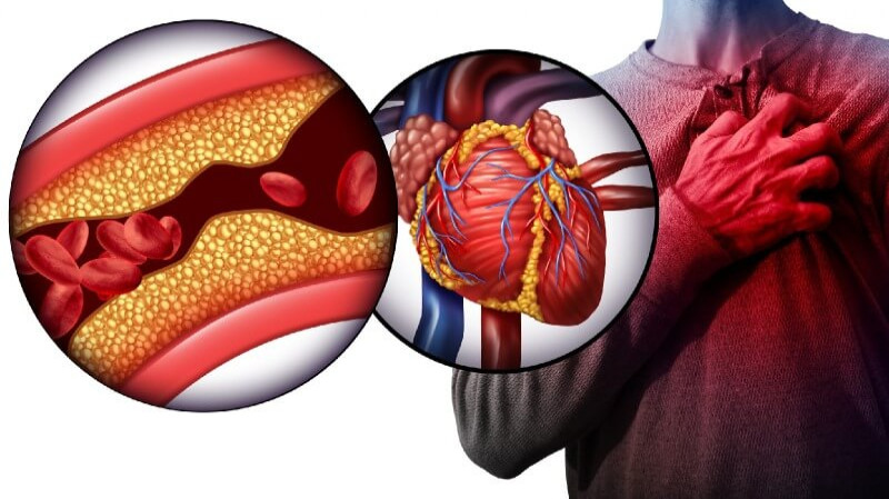 Symptoms of Heart Disease Across Different Age Groups and Genders |  Narayana Health