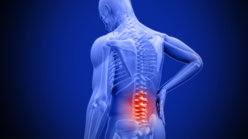 Low Back Pain